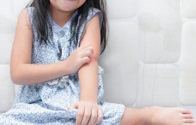 A girl scratching mosquito bites