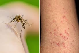 Dengue during vacation