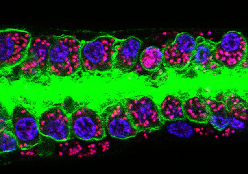 Wolbachia bacteria